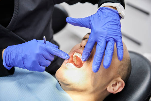 Best Emergency Treatment for Dental Infections or Abscesses in Cliffside Park, NJ