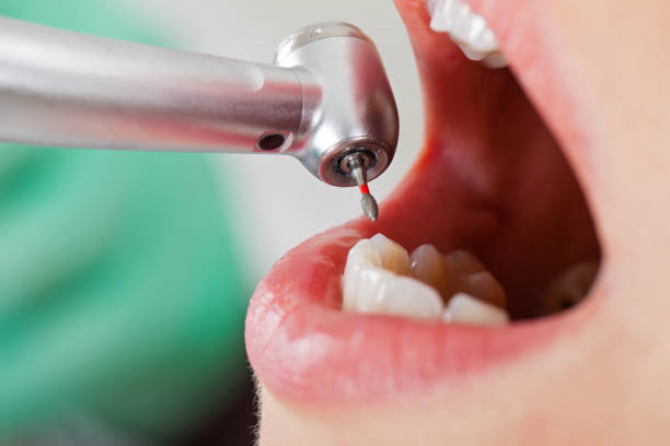 Best Emergency Treatment for Dental Infections or Abscesses in Cliffside Park, NJ